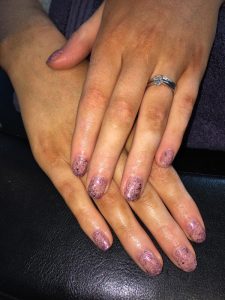 Shellac Yateley- Christiane Dowling